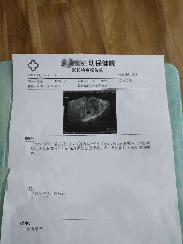 46岁广州谢女士移植XY囊胚成功妊娠